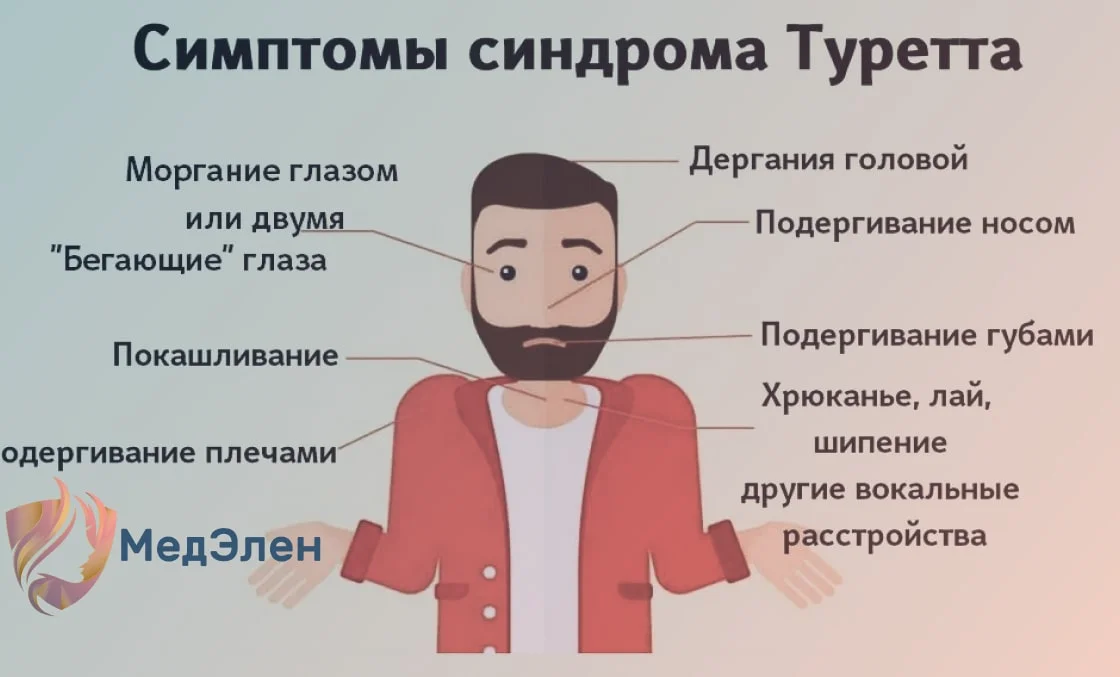 Проявления синдрома Туретта
